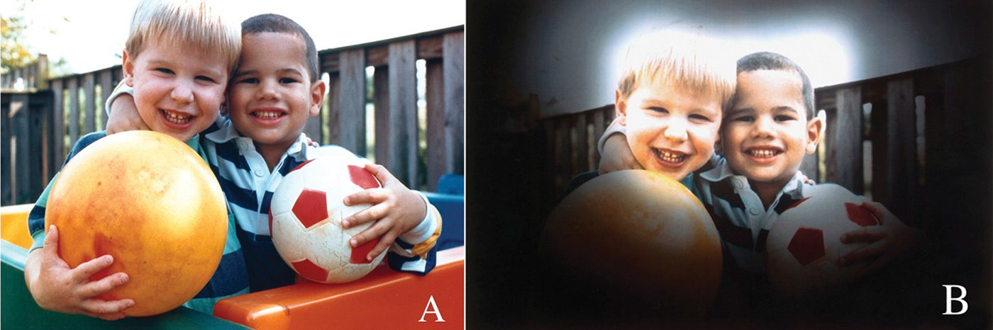 jak widzą ludzie z jaskrą